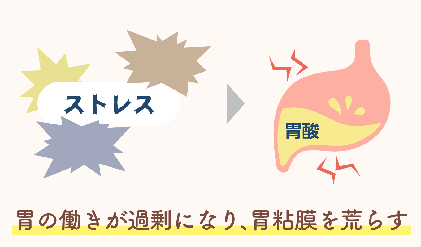 ストレス性胃腸炎とは？何日で治る？仕事は休むべき？｜西春内科・在宅クリニック